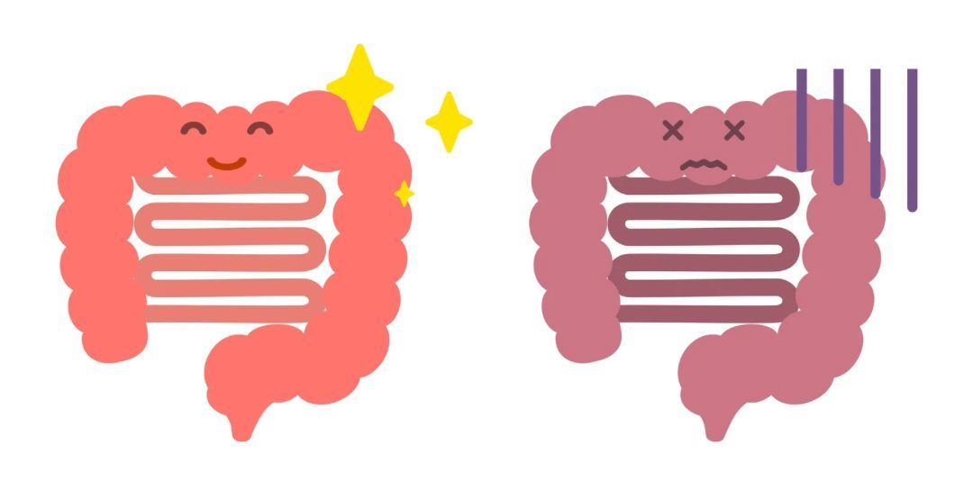 健康な腸と不健康な腸